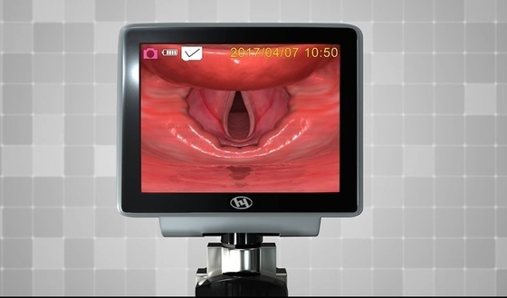 Laryngoscope 1320 visuel optique en plastique de fibre en métal de HYHJ avec les lames jetables