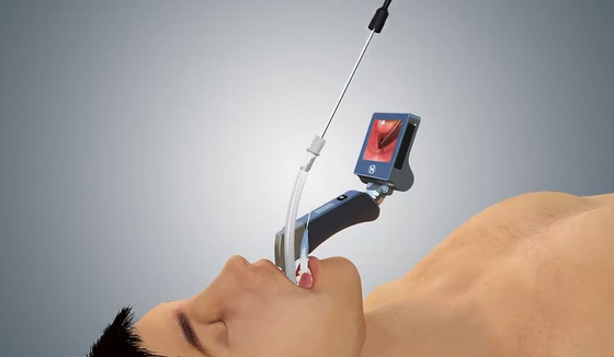 Laryngoscope de 5 Mac Miller Blades Medical Digital Video avec la jambe ergonomique de main