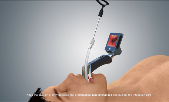Source lumineuse visuelle chirurgicale médicale imperméable du laryngoscope LED de HYHJ-KC