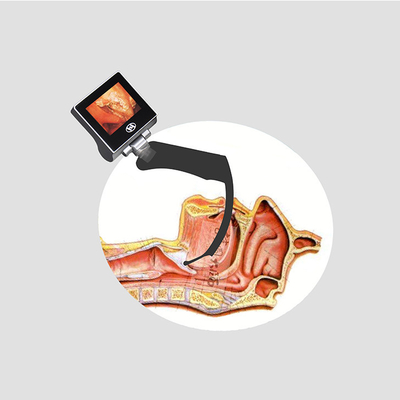 Laryngoscope visuel tenu dans la main d'intubation de CMOS avec la visualisation hyperangulée de glotte de 70 degrés