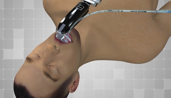L'Usb optique de laryngoscope d'Endoscope électronique oto-rhino d'hôpital d'écran de 3,0 pouces a produit