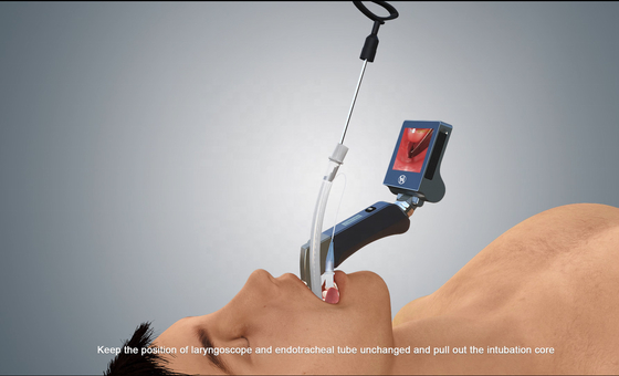 Laryngoscope visuel optique réutilisable ISO13485 de Mcgrath de fibre de lames