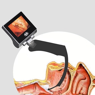 Laryngoscope visuel d'anesthésie réutilisable d'affichage à cristaux liquides de 360 degrés 2 millions de pixel