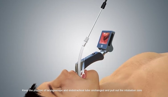 Laryngoscope visuel de Digital en métal de Médical-catégorie de HYHJ-KC d'anti de brouillard système matériel de caméra