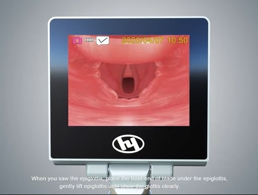 Laryngoscope visuel d'anesthésie rigide OTO-RHINO d'ambulance avec la lame de difficulté